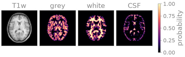 T1w, grey, white, CSF
