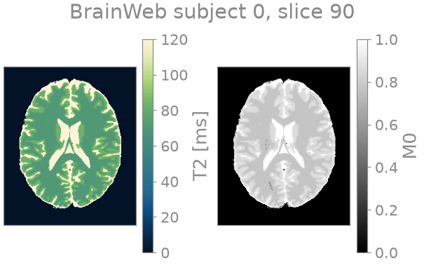 BrainWeb subject 0, slice 90