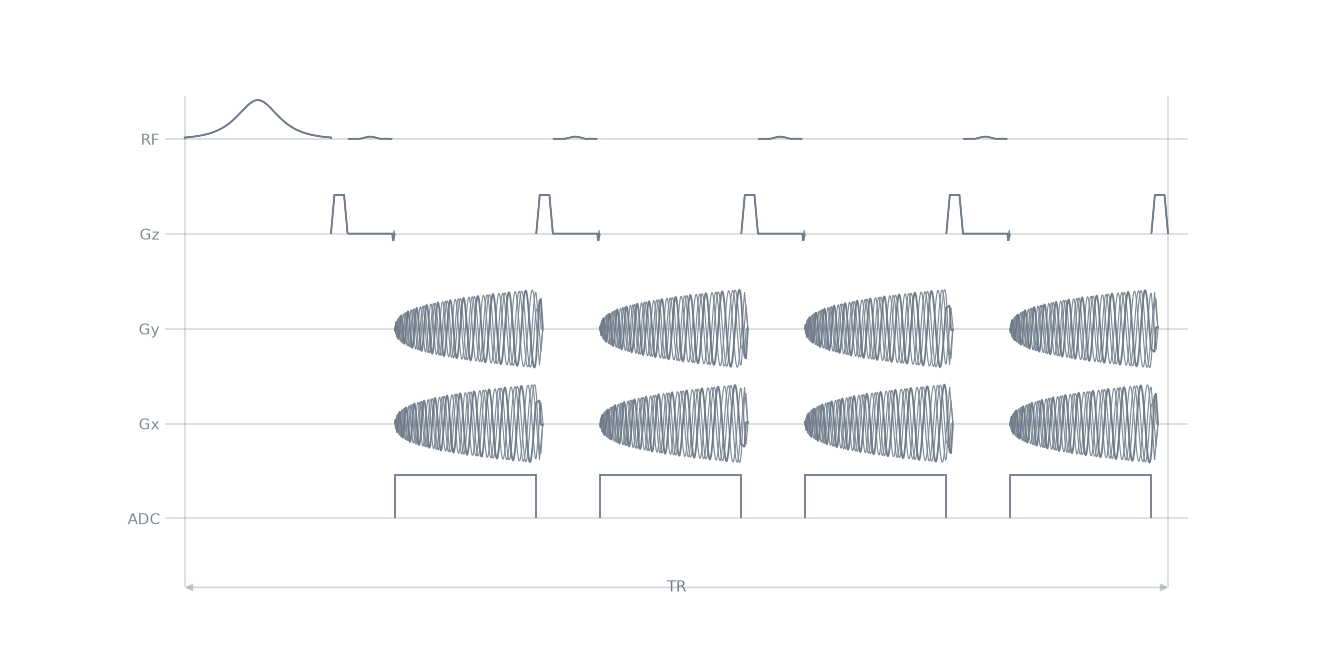 mprage stack of spirals3D sequence