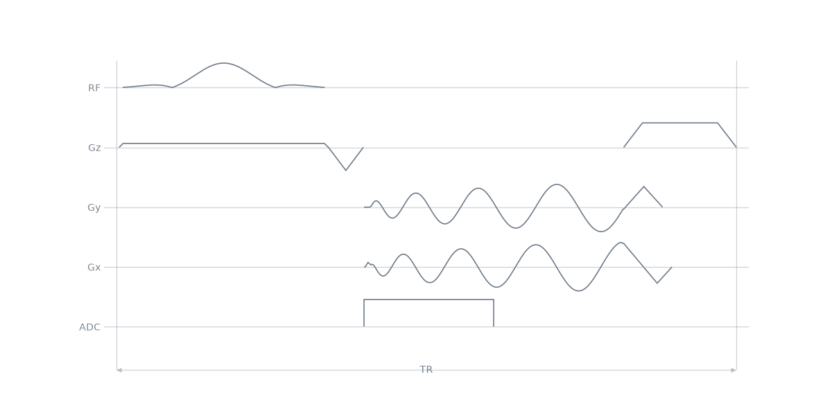 03 noncartesian readout