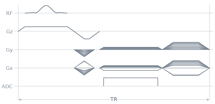 05 radial sampling