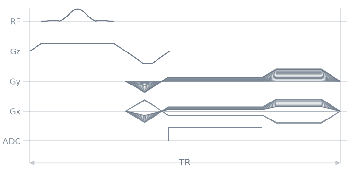 05 radial sampling