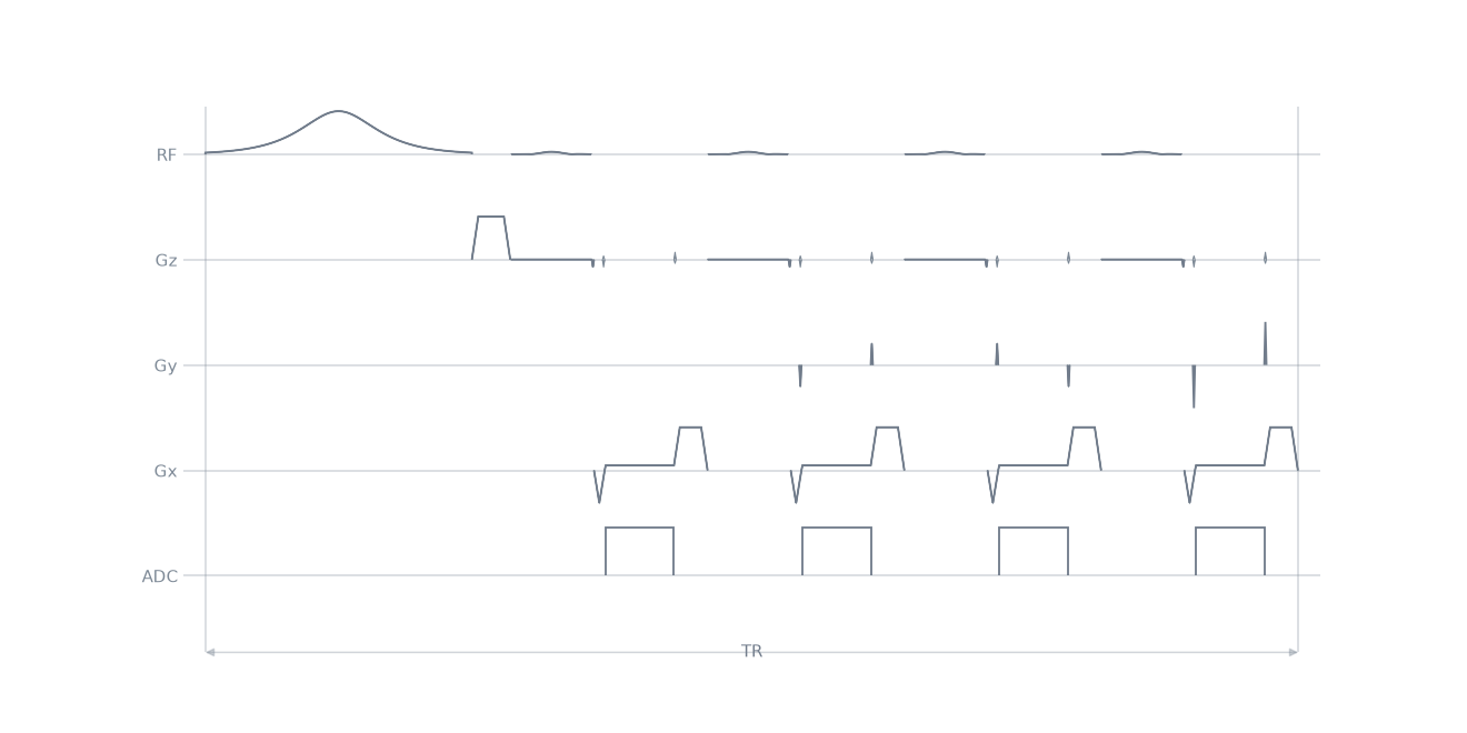 mprage3D sequence