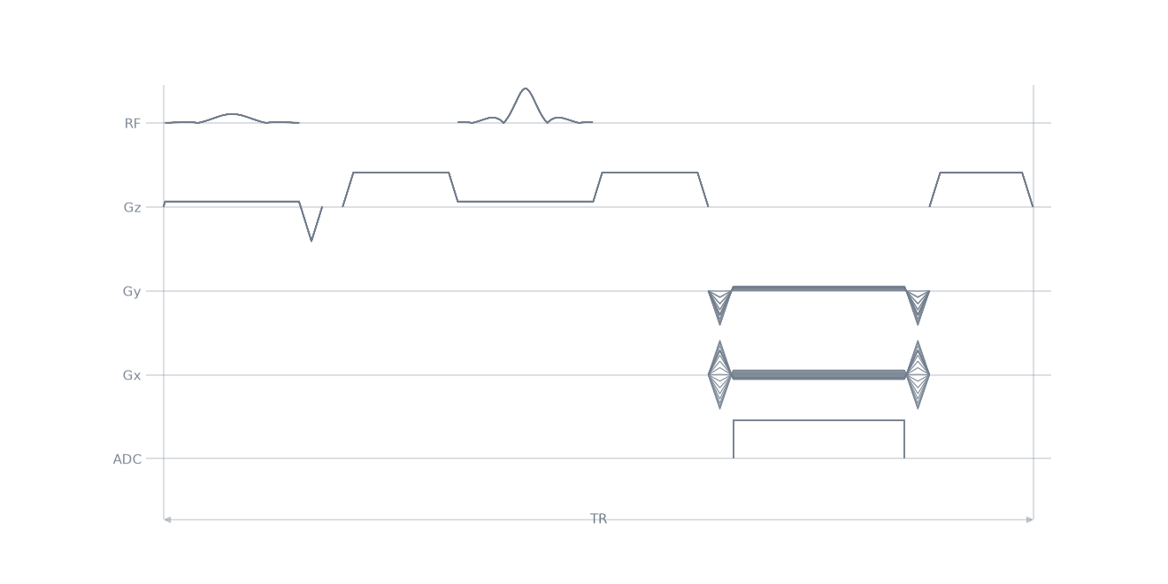 se radial2D sequence