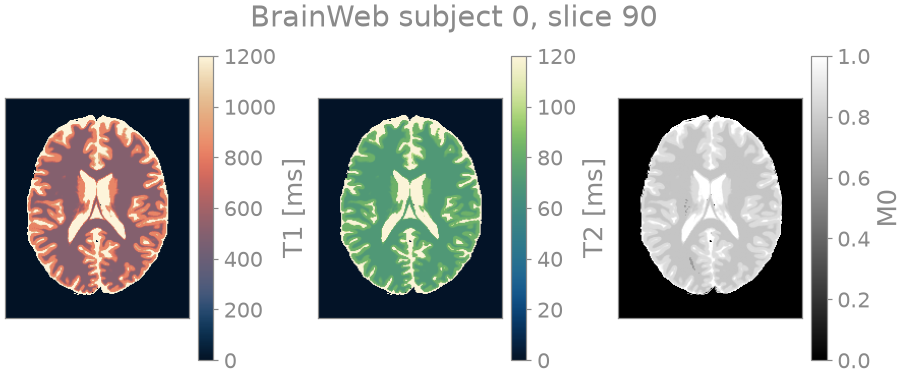 BrainWeb subject 0, slice 90