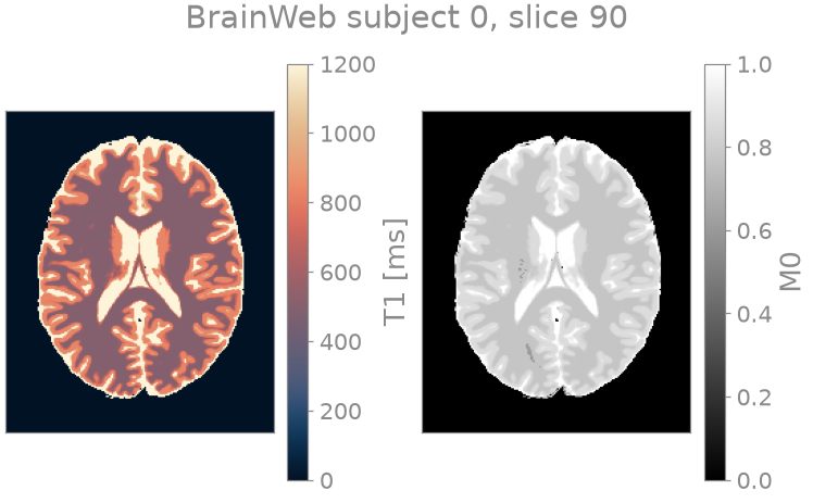 BrainWeb subject 0, slice 90