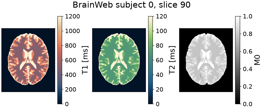 BrainWeb subject 0, slice 90