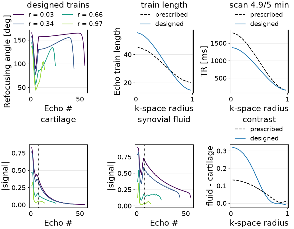 designed trains, train length, scan 4.9/5 min, cartilage, synovial fluid, contrast