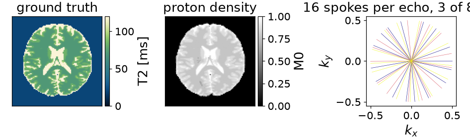 ground truth, proton density, 16 spokes per echo, 3 of 8 shown