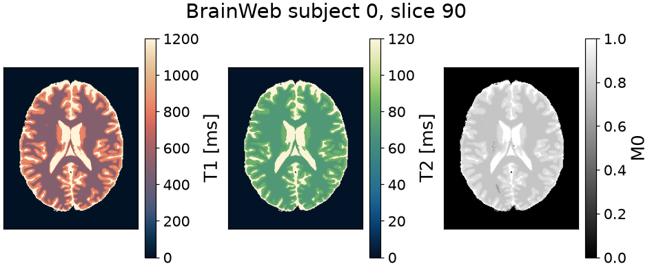 BrainWeb subject 0, slice 90