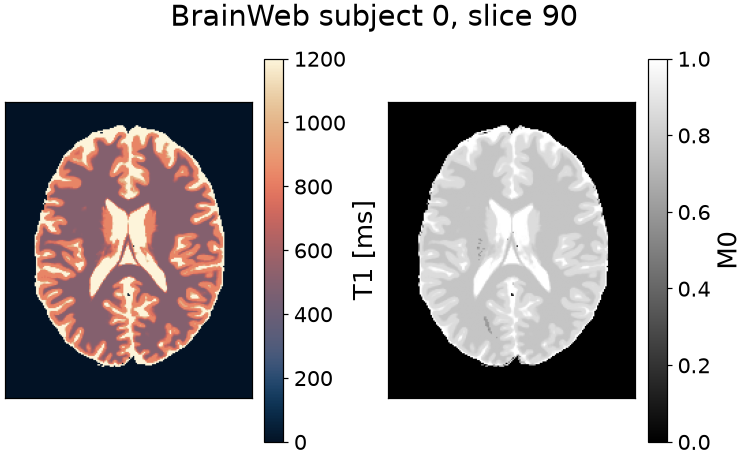 BrainWeb subject 0, slice 90