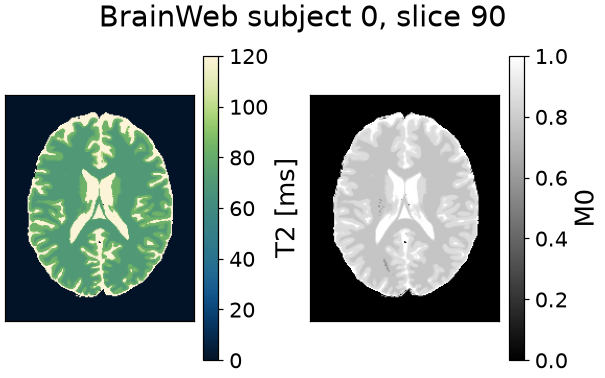 BrainWeb subject 0, slice 90